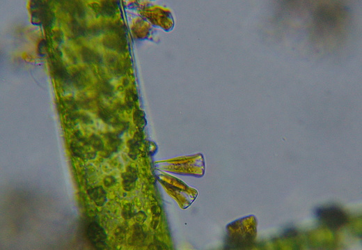 Gomphonema