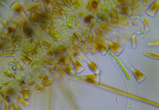 Gomphonema