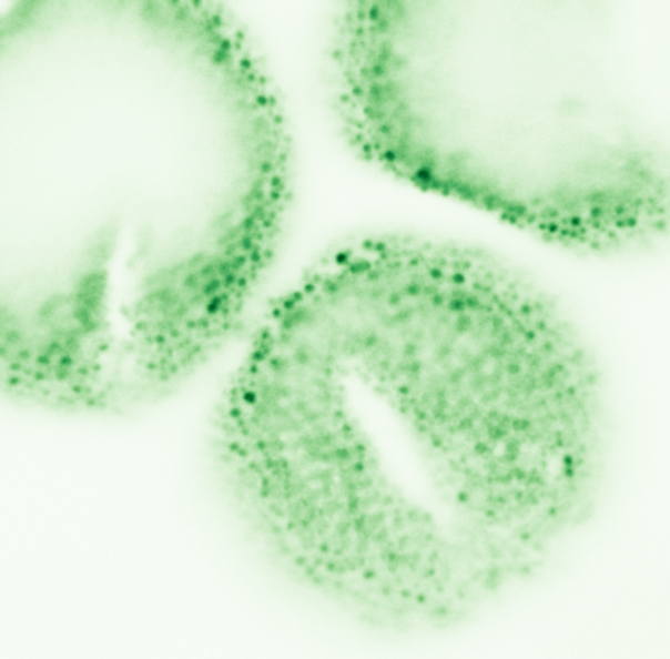 Geranium_robertianum_95x95um_3.png